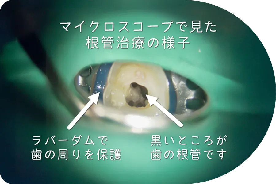 細部の検診